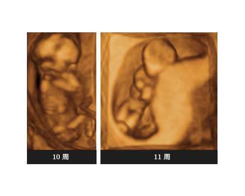 供卵供卵代怀的流程_亲戚供卵合法吗,来宾供卵供卵代怀三代生男孩价格