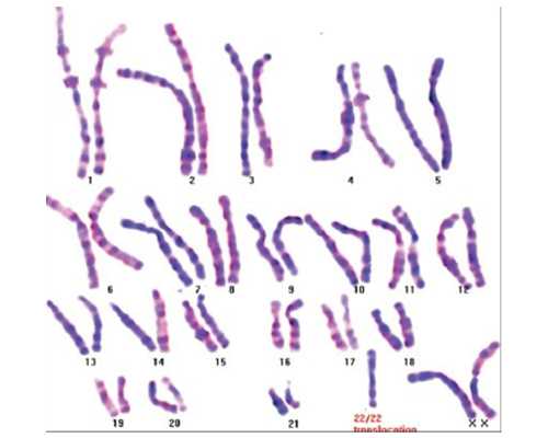 三代试管介绍_捐卵试管,福州试管婴儿价格,福州试管婴儿收费标准