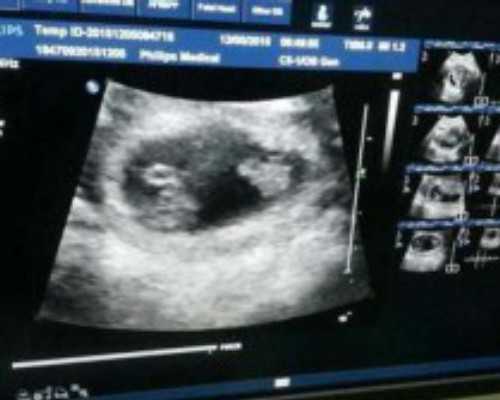 广州供卵试管代怀生子医院排名，附供卵生男孩费用一览！_代怀靠谱中介