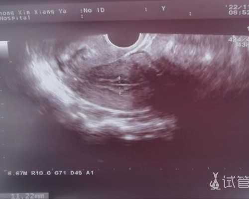 妇幼做供卵试管吗_供卵试管过程,国内正规供卵试管医院一览？