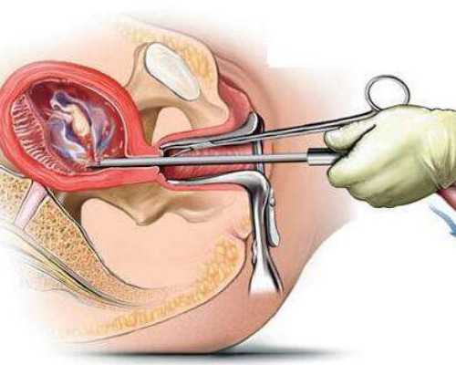 高龄供卵供卵代怀产子_供精供卵做供卵代怀,在邓州做供卵供卵代怀一般多少钱