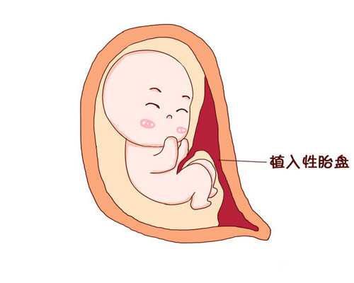 泰国试管婴儿医院各有哪些优势泰国试管婴儿医